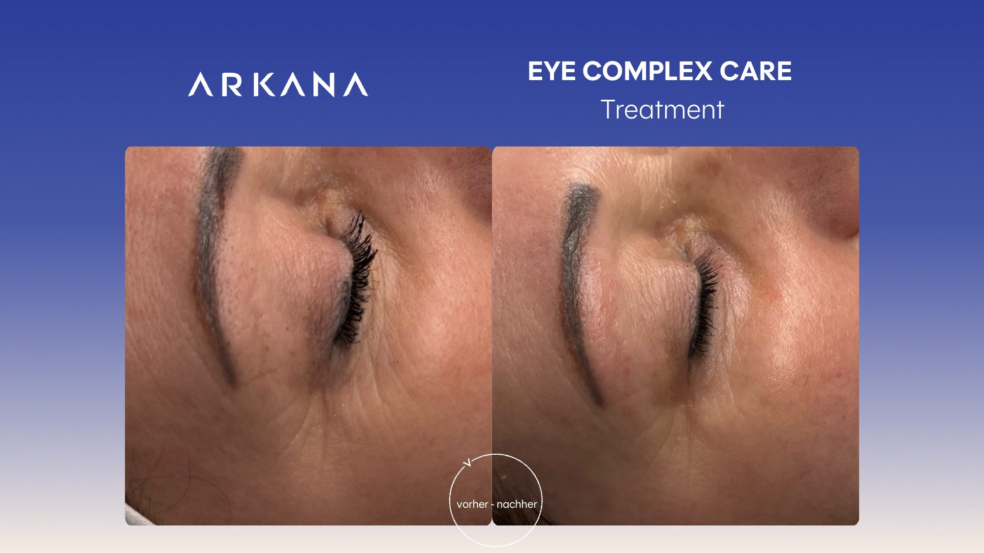 Vorher-Nachher Ergebnis: Eye Complex Care Treatment
